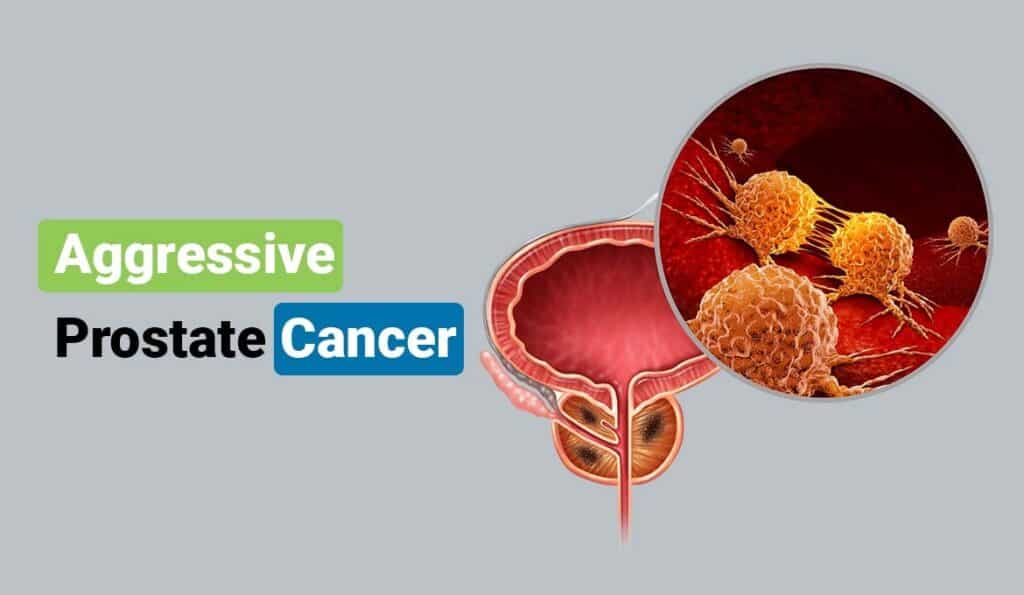  How Fast Does Aggressive Prostate Cancer Grow 