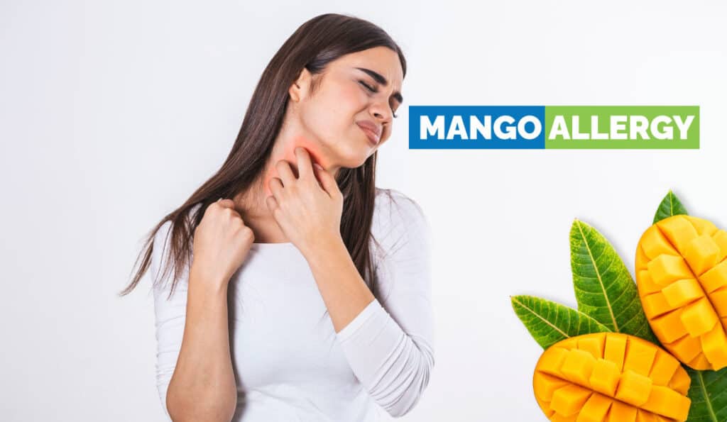 Mango Allergy - Symptoms, Causes, Prevention, Treatments, More