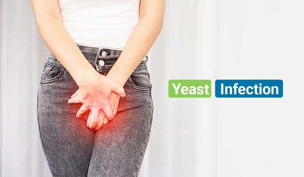 how-to-get-rid-of-a-yeast-infection-in-24-hours-healthy-active