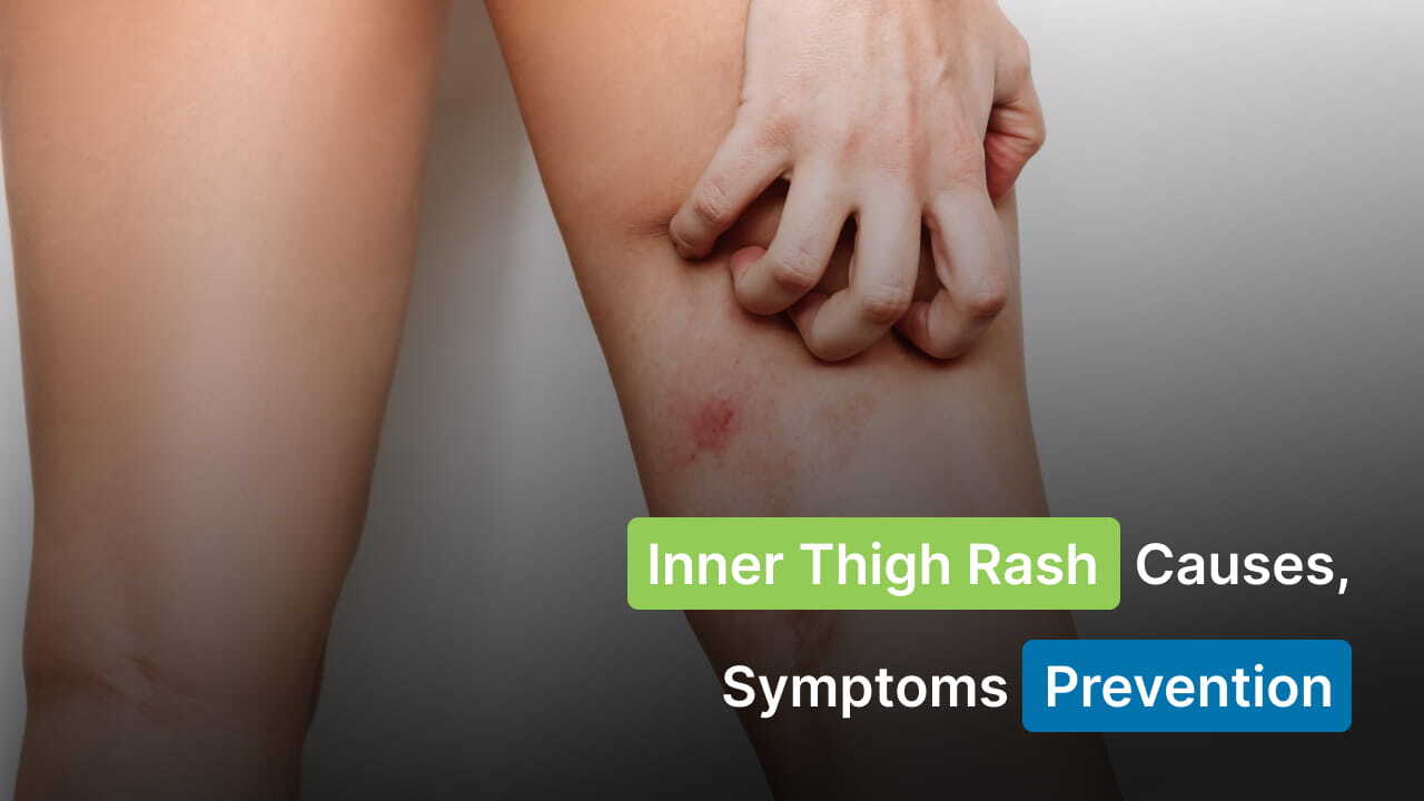 inner thigh rash